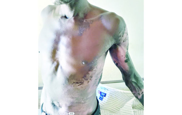 Mjolo Will Kill Us! Man Scalded For Accusing Wife of Cheating With His Nephew!