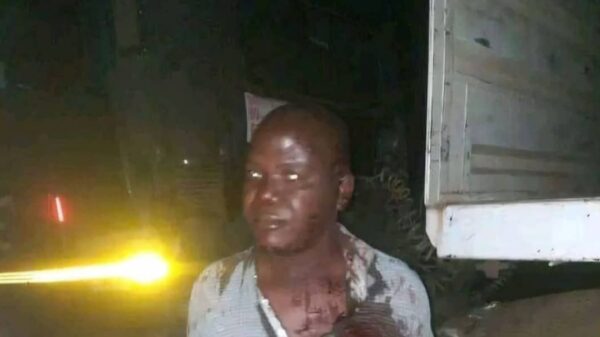 Truck Driver Attacked by Armed Robbers Near Rusape River. Photocredit-X