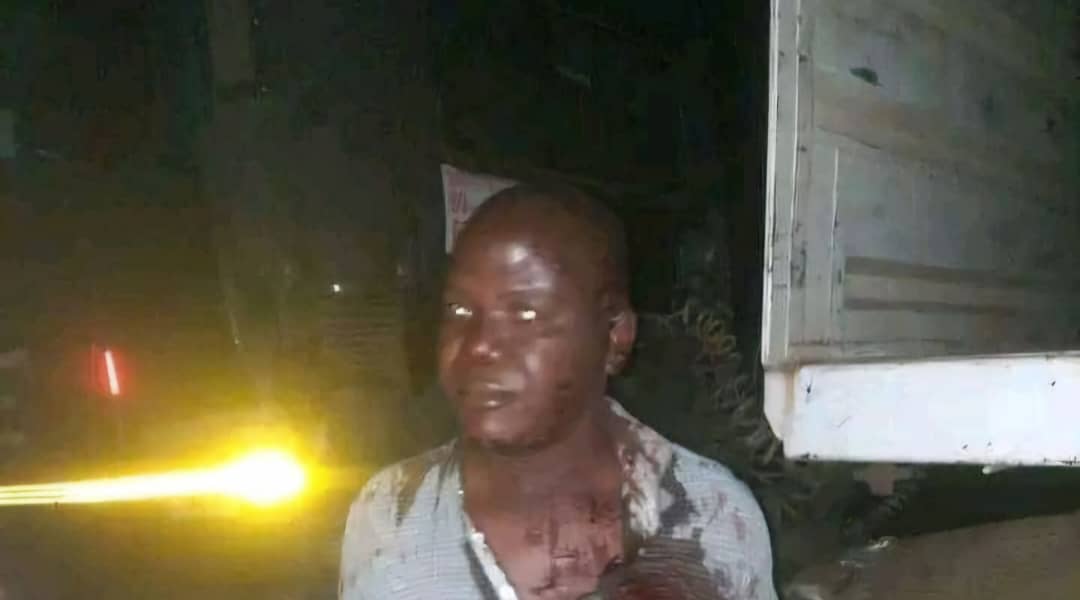 Truck Driver Attacked by Armed Robbers Near Rusape River. Photocredit-X